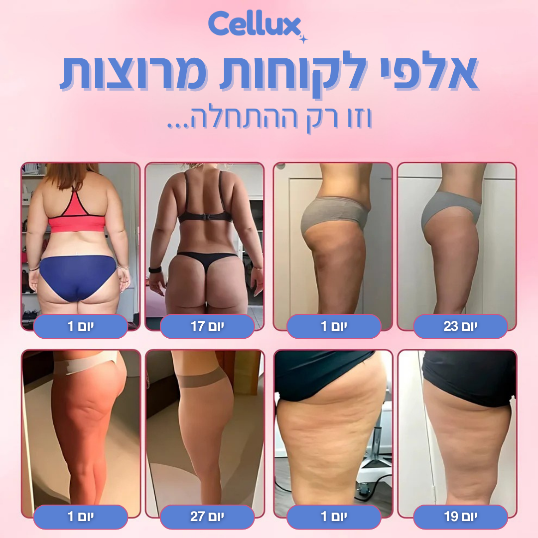 Cellux — Cellux מול מכוני טיפול בצלוליט: השוואה מקיפה