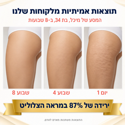 Cellux - ערכה ביתית לטיפול בצלוליט וסימני מתיחה
